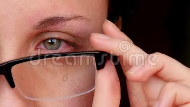 一个年轻女人生病的红眼。 一个女孩摘下眼镜，露出一只红眼睛。 电脑上的眼睛很累。
